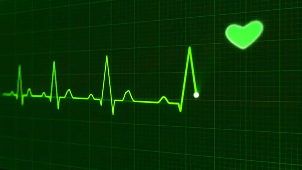 A real-time electrocardiogram.