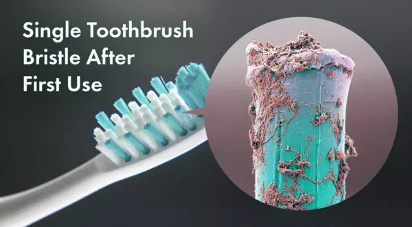 Toothbrush Sterlizer
